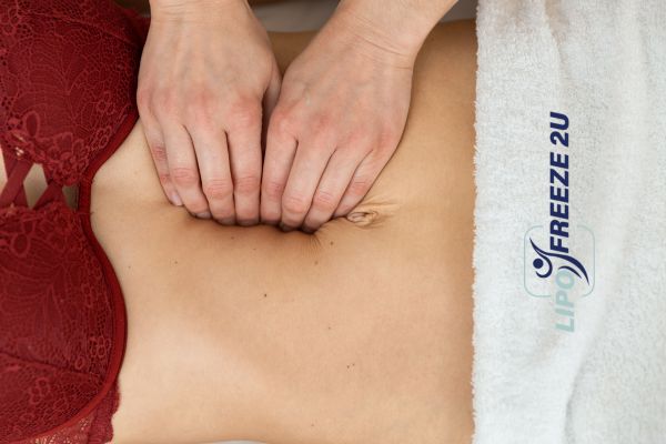diastasis recti treatment Northolt