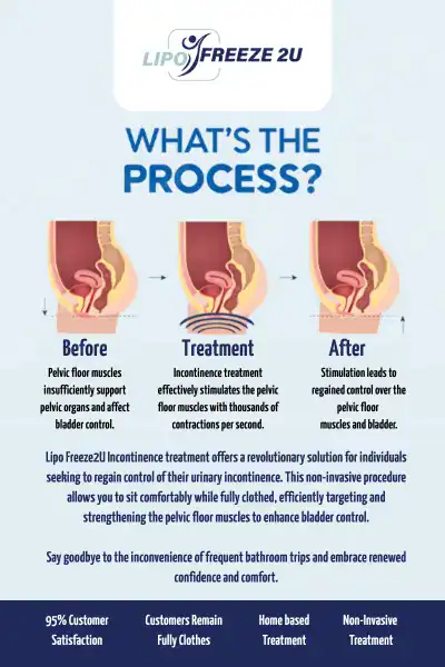 Diagram of how incontinence treatment Northolt works.