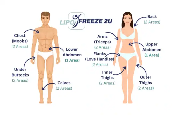 Areas you can have fat freezing treatment Northolt