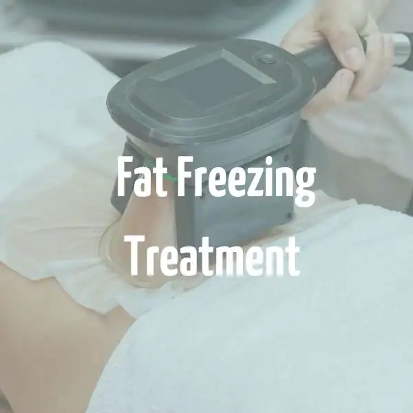 fat freezing treatment Northolt