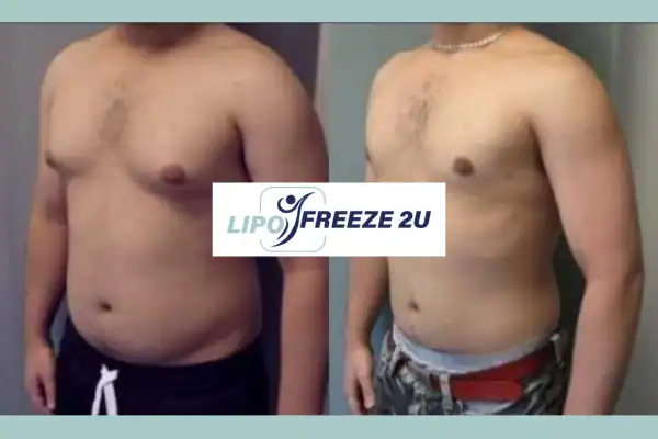 How Long Does It Take to See Results Northolt?