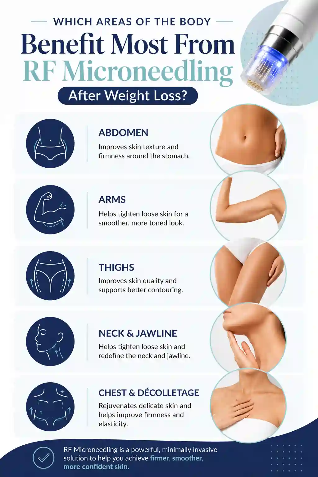 Which Areas of the Body Benefit Most From RF Microneedling After Weight Loss Northolt
