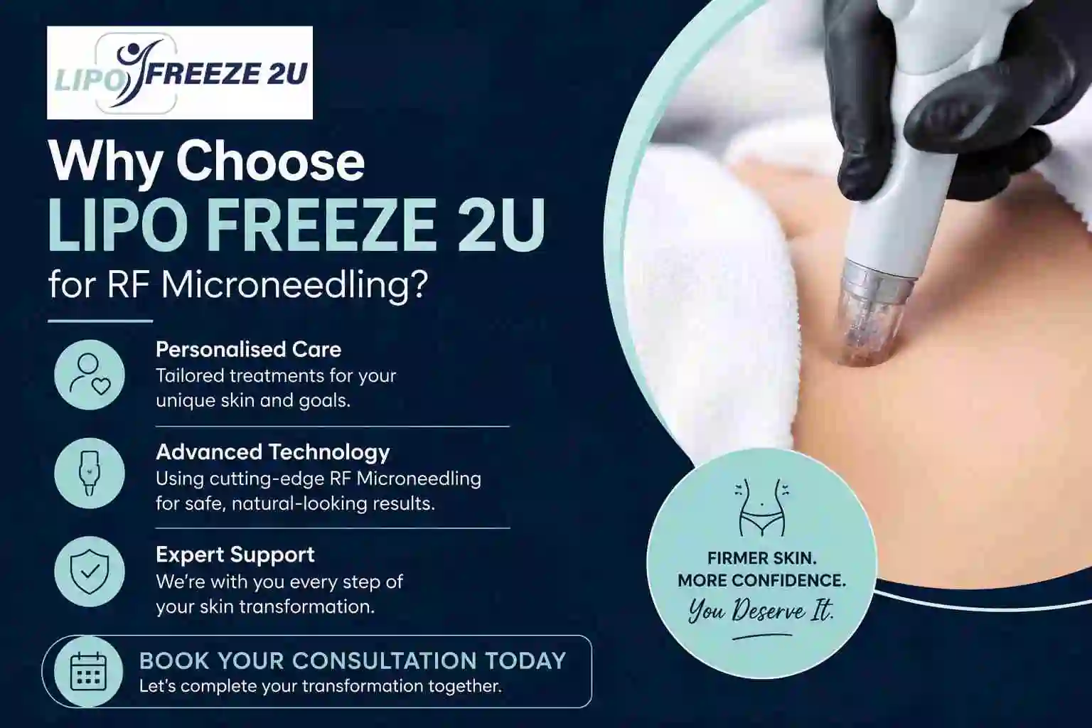 Why Choose LIPO FREEZE 2U for RF Microneedling Northolt?